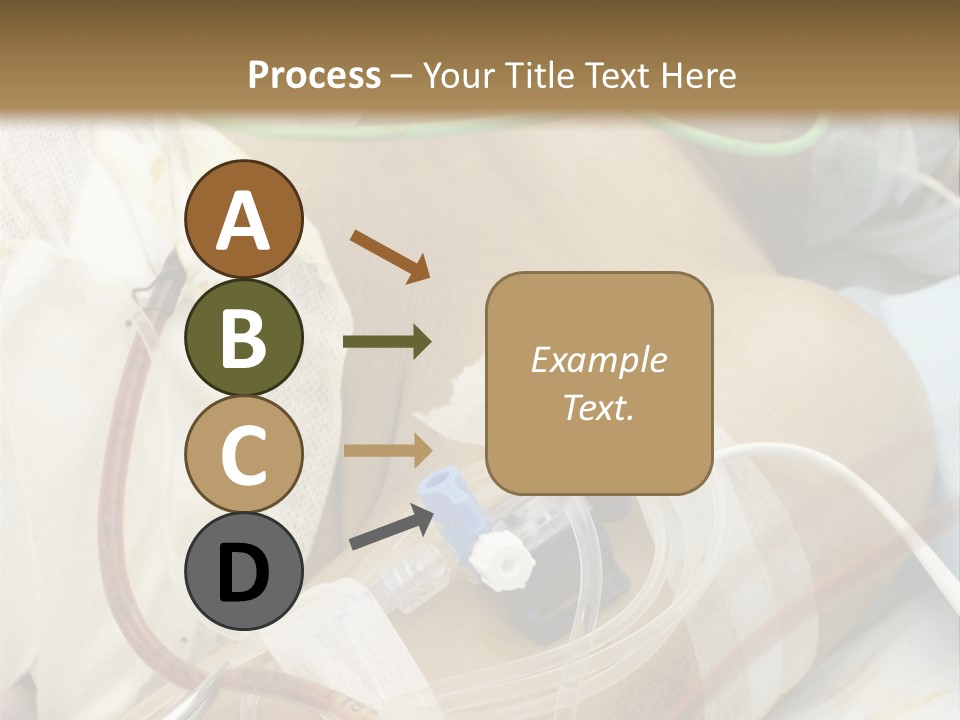 A Man On A Drip PowerPoint Template