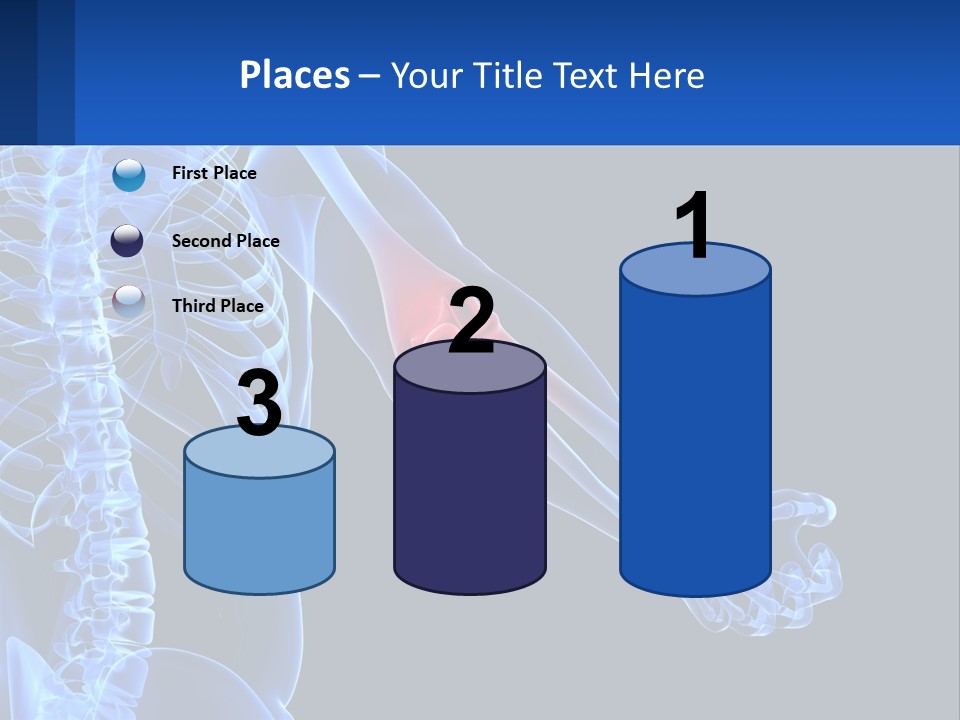 Elbow Pain PowerPoint Template