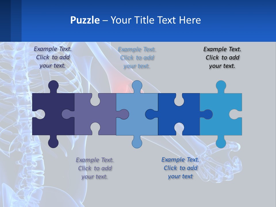 Elbow Pain PowerPoint Template