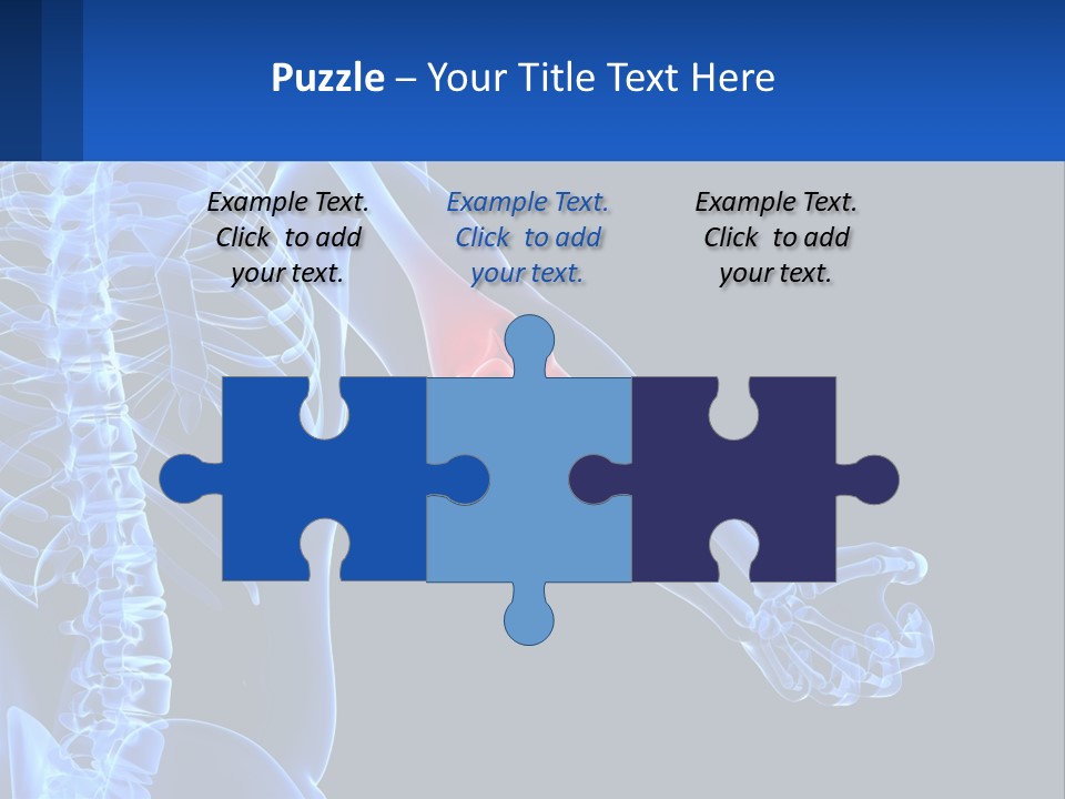 Elbow Pain PowerPoint Template