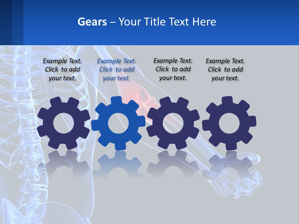 Elbow Pain PowerPoint Template