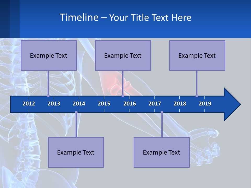 Elbow Pain PowerPoint Template
