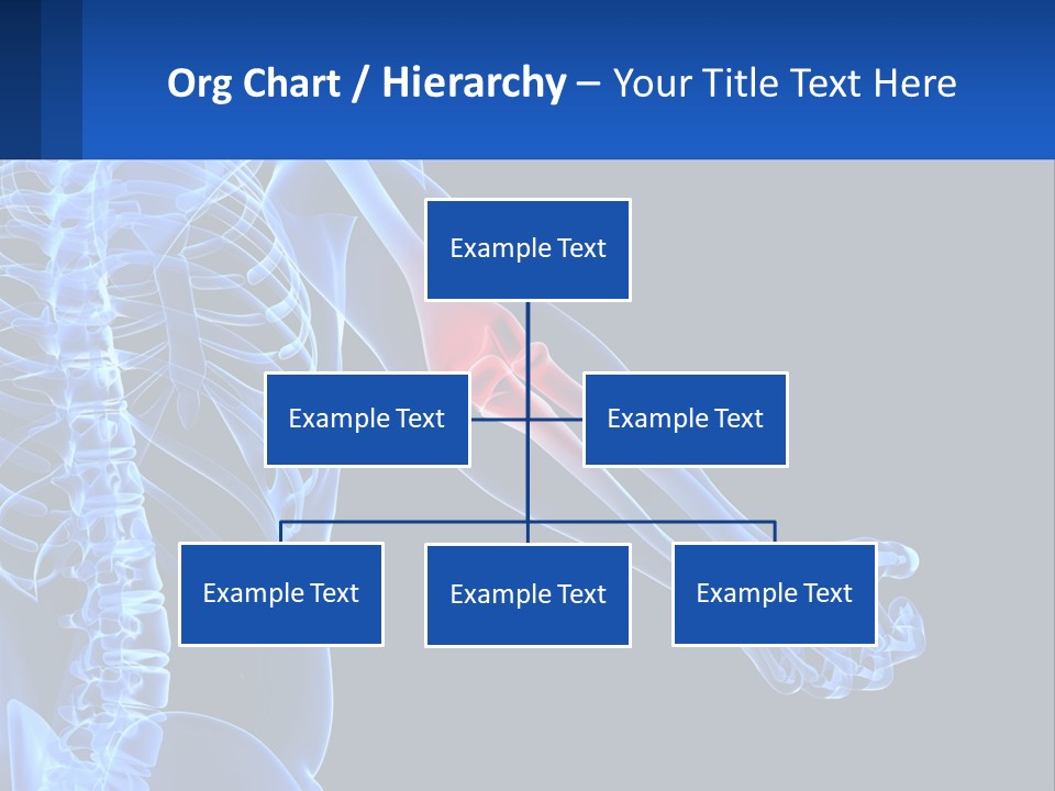 Elbow Pain PowerPoint Template