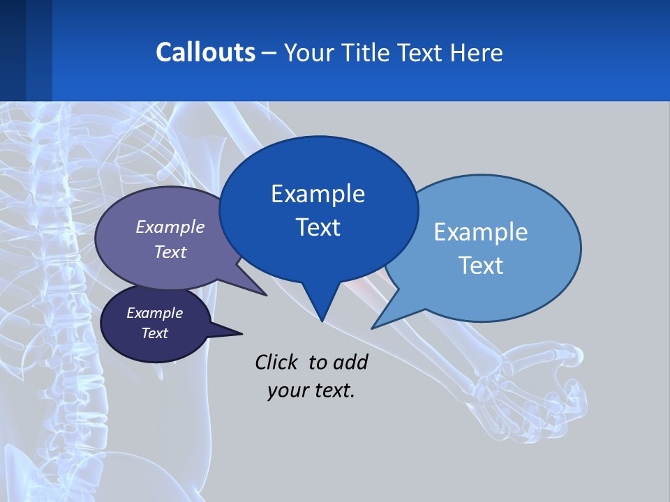 Elbow Pain PowerPoint Template