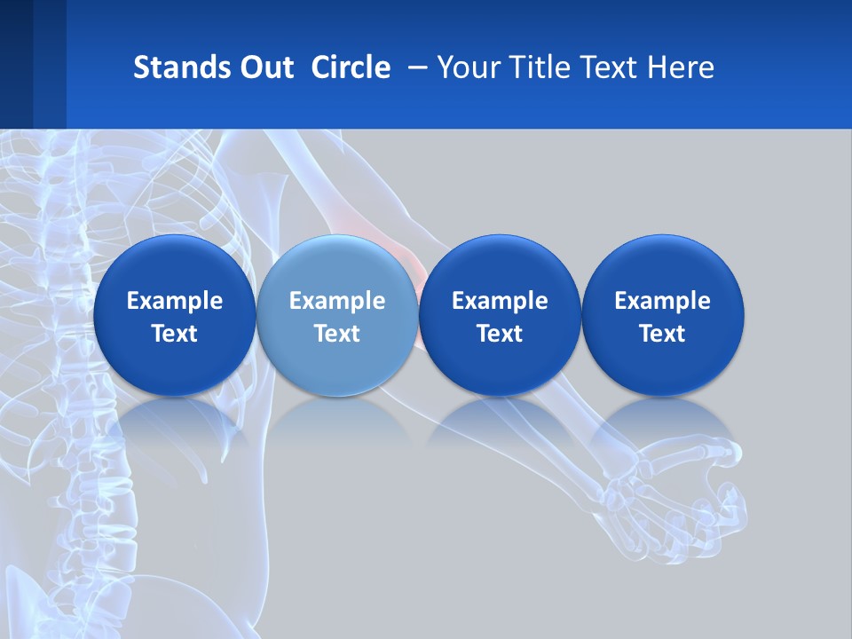 Elbow Pain PowerPoint Template