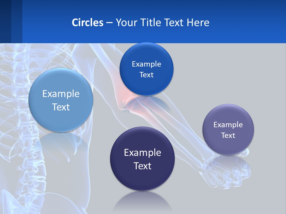 Elbow Pain PowerPoint Template