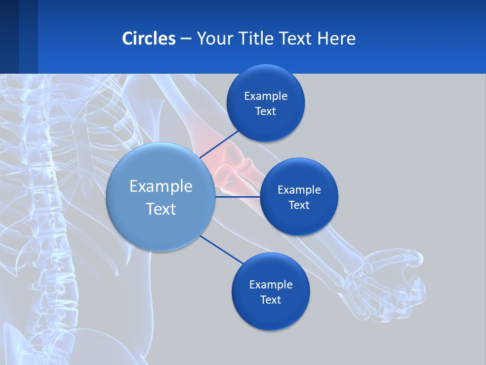 Elbow Pain PowerPoint Template