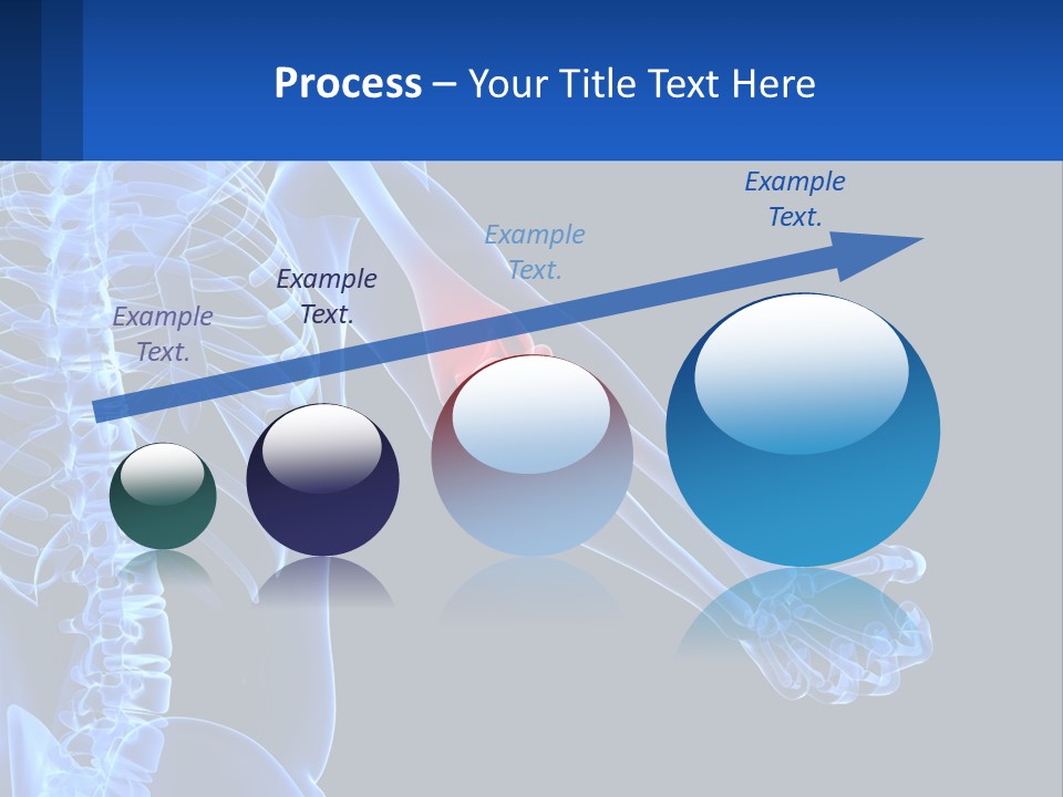 Elbow Pain PowerPoint Template
