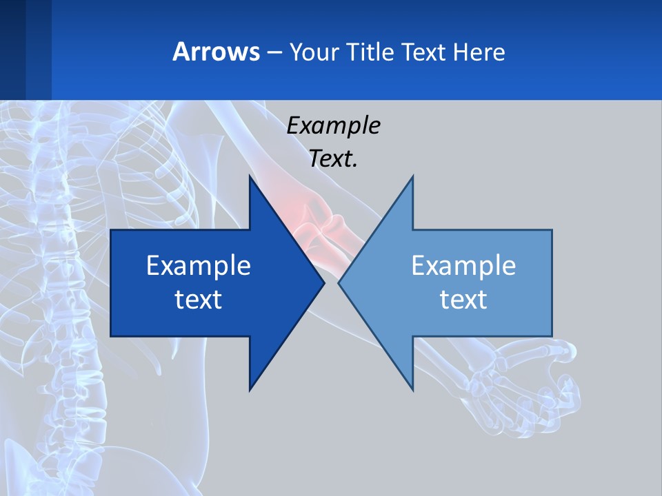 Elbow Pain PowerPoint Template