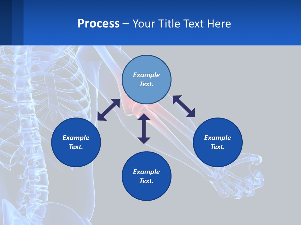 Elbow Pain PowerPoint Template