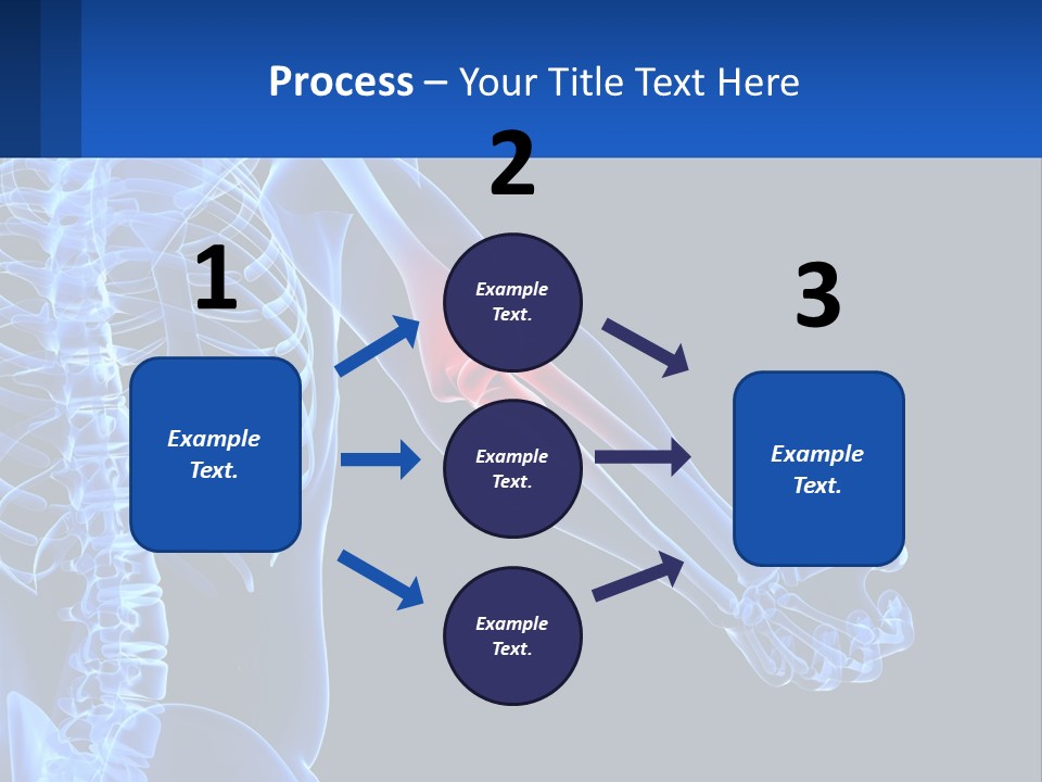 Elbow Pain PowerPoint Template