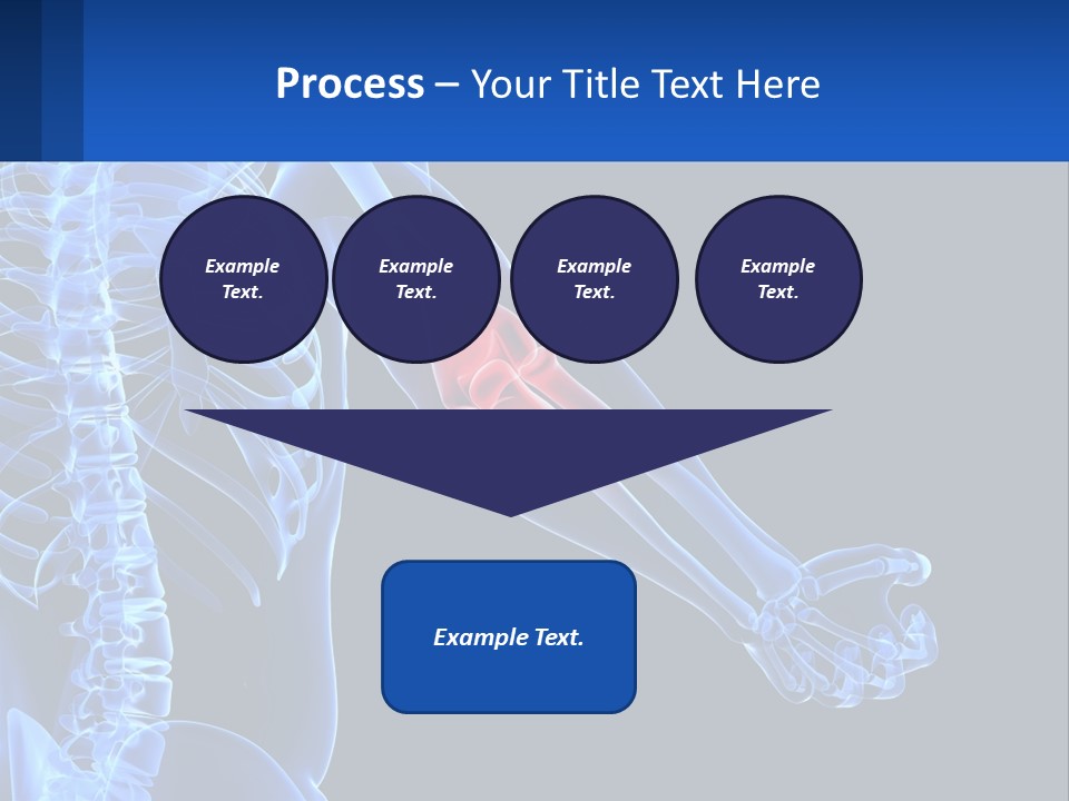 Elbow Pain PowerPoint Template