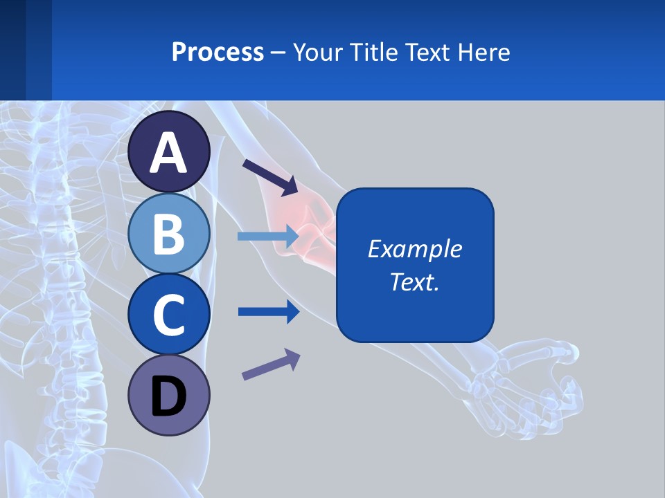 Elbow Pain PowerPoint Template