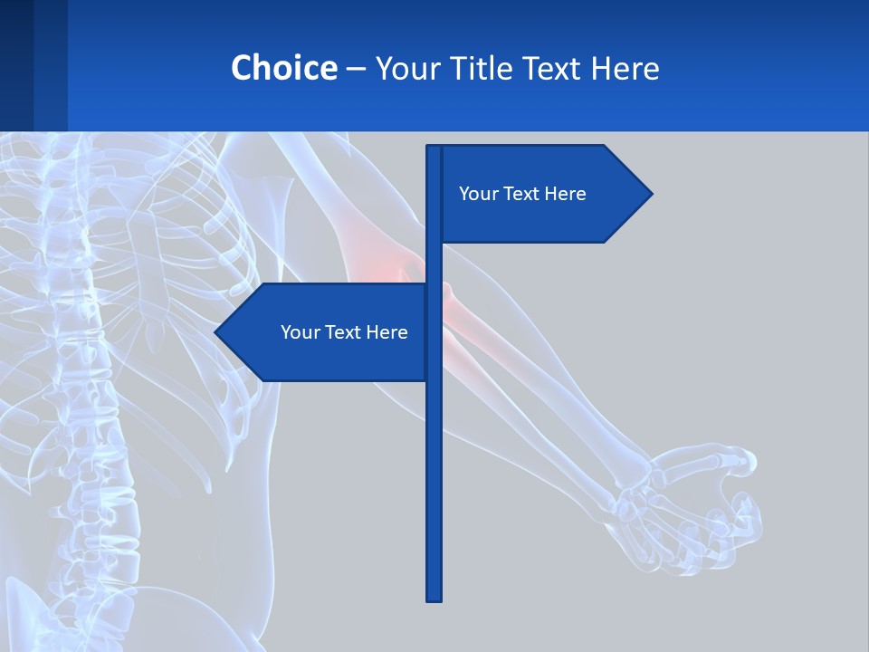 Elbow Pain PowerPoint Template