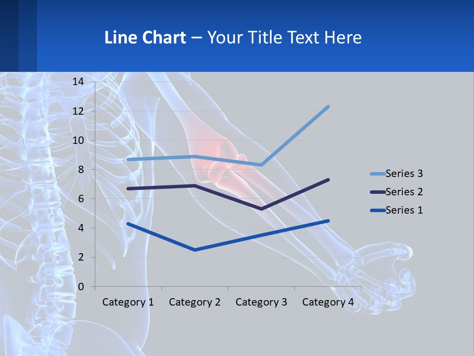 Elbow Pain PowerPoint Template
