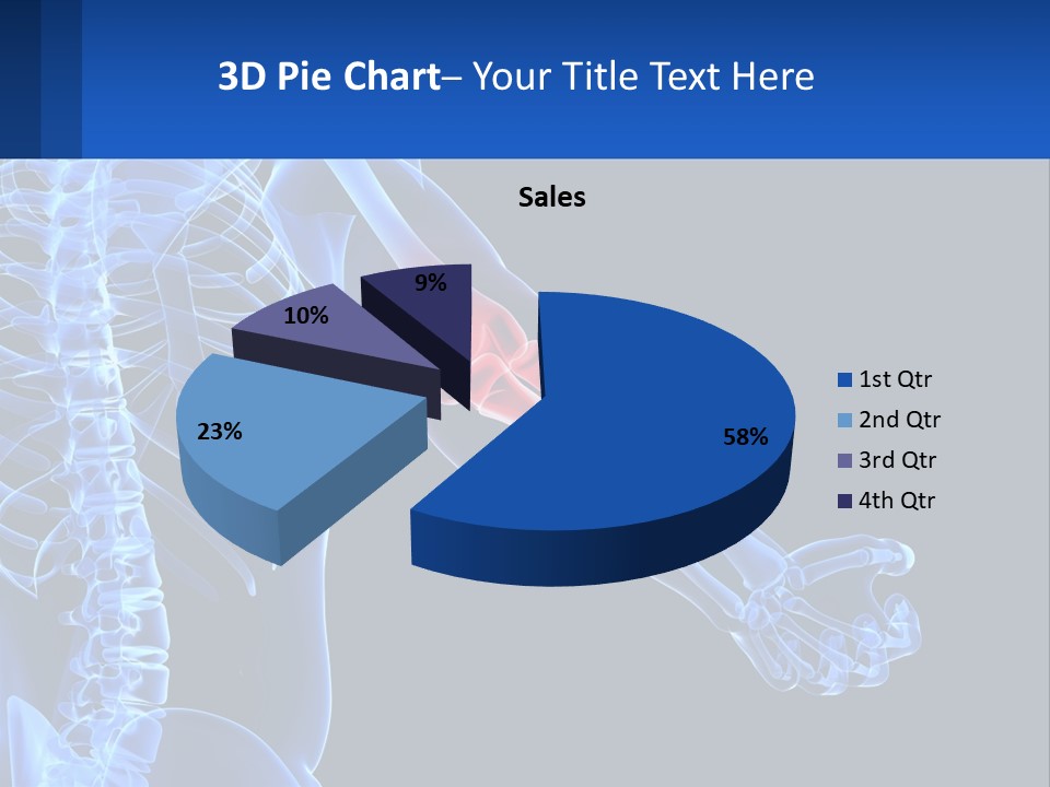 Elbow Pain PowerPoint Template