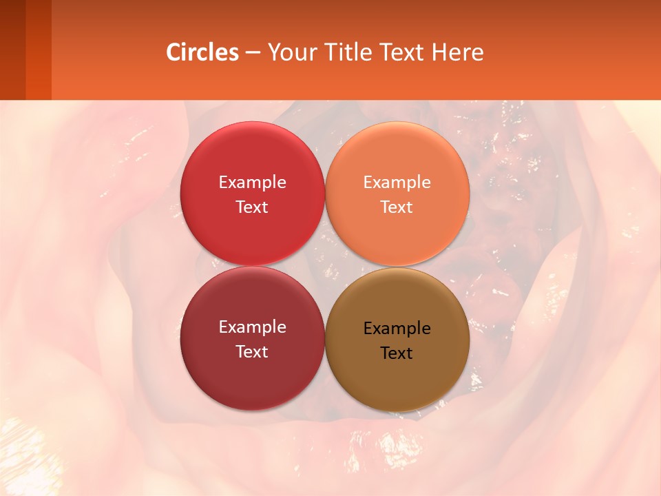 Ulcer PowerPoint Template