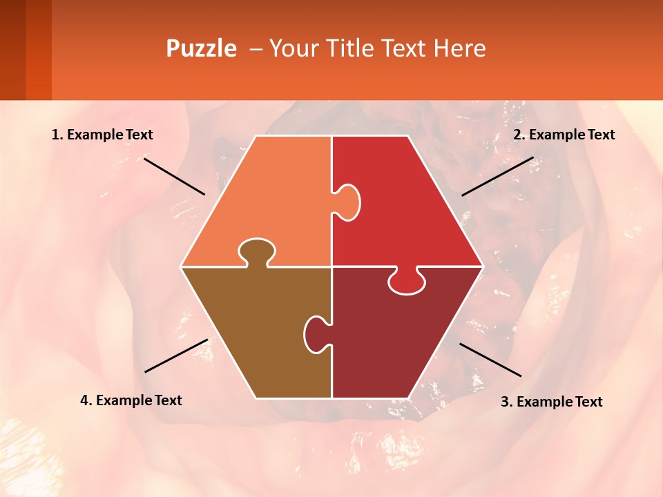 Ulcer PowerPoint Template