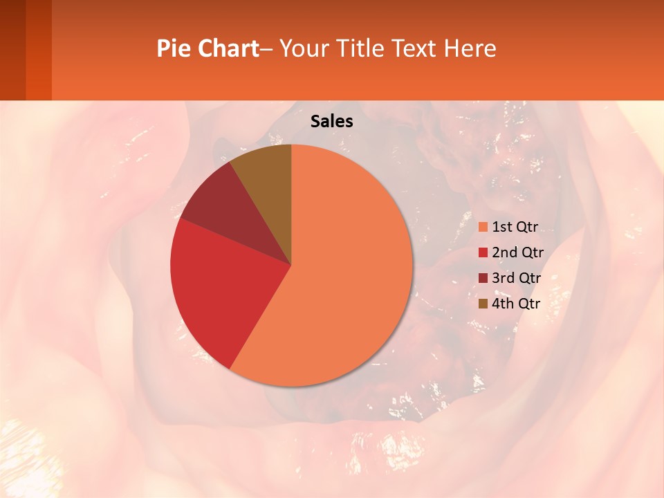 Ulcer PowerPoint Template