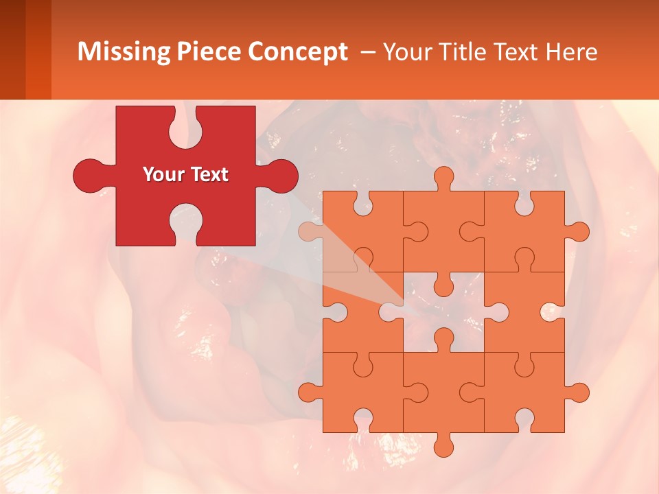 Ulcer PowerPoint Template