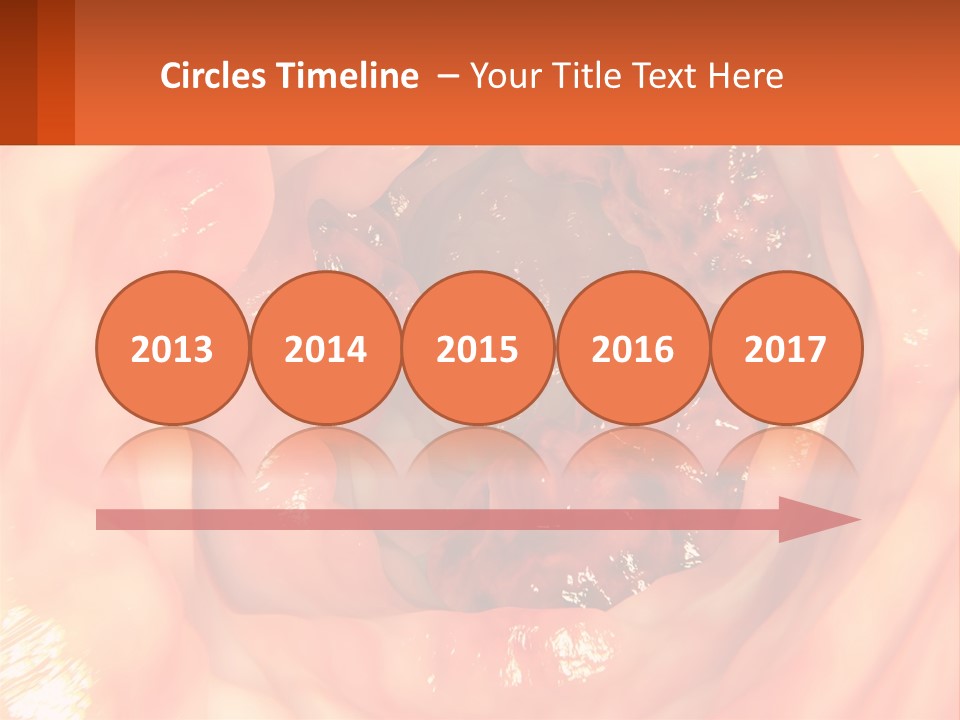 Ulcer PowerPoint Template