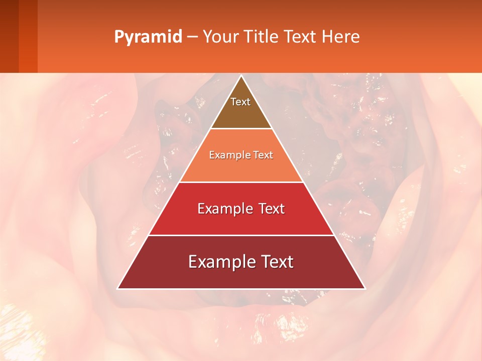 Ulcer PowerPoint Template