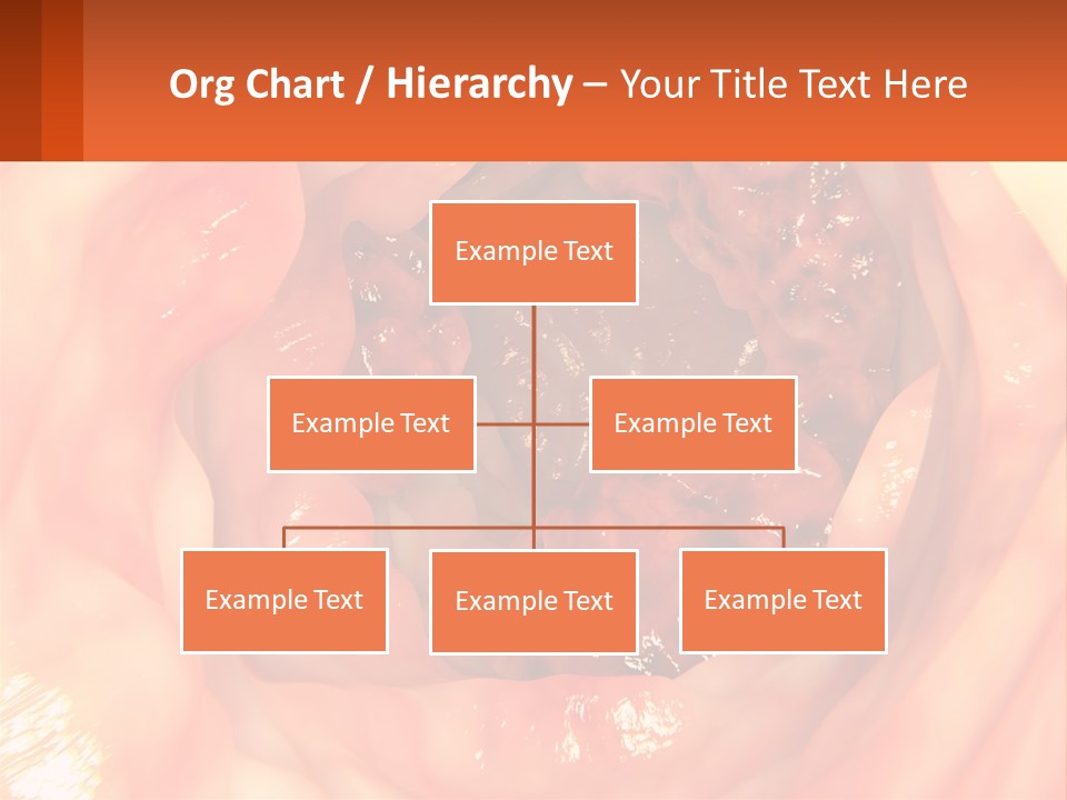 Ulcer PowerPoint Template