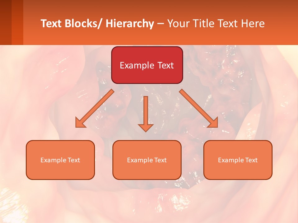 Ulcer PowerPoint Template