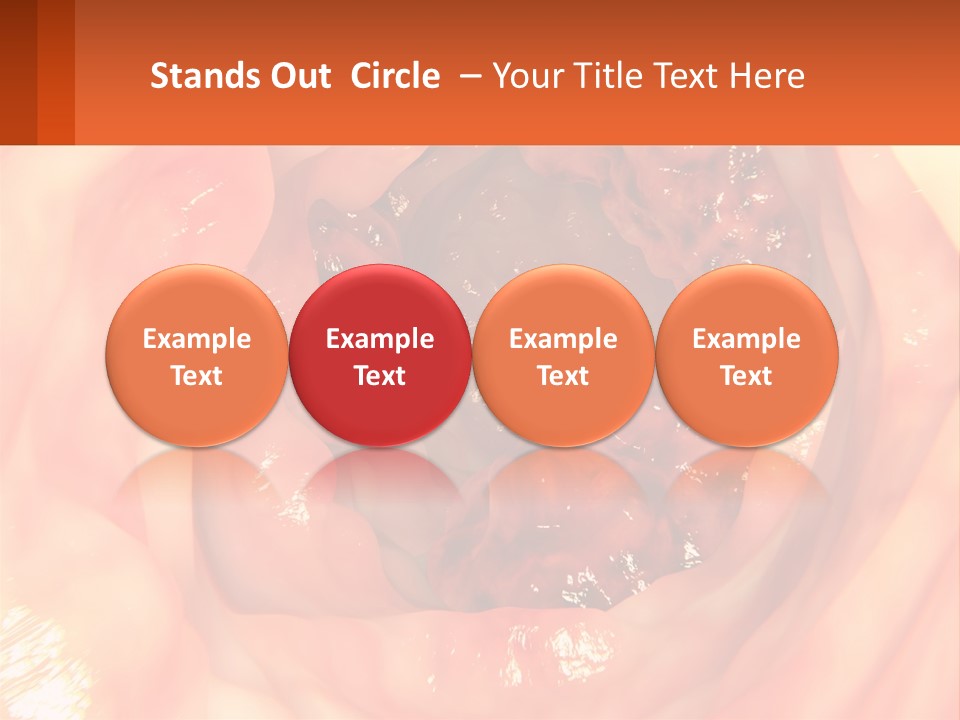 Ulcer PowerPoint Template