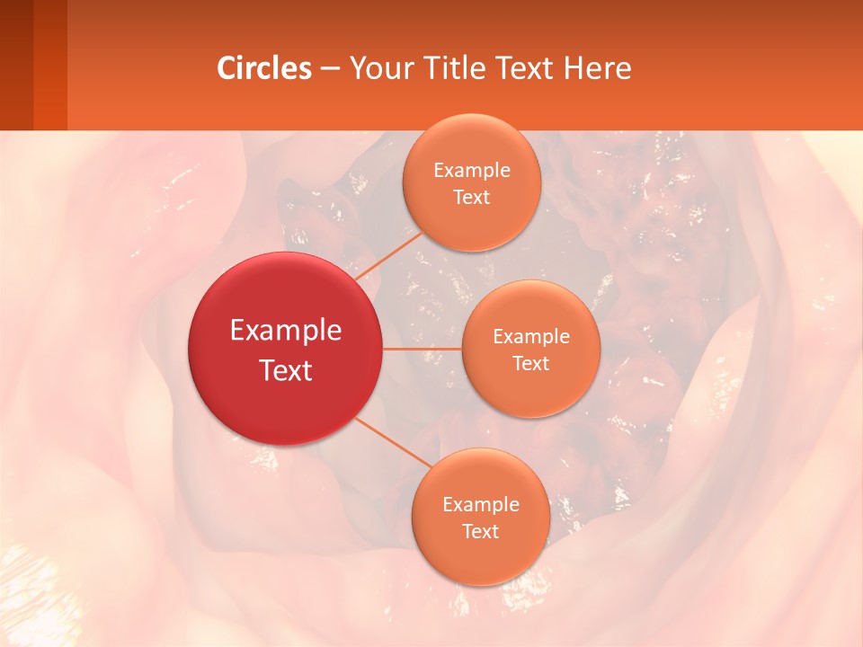 Ulcer PowerPoint Template