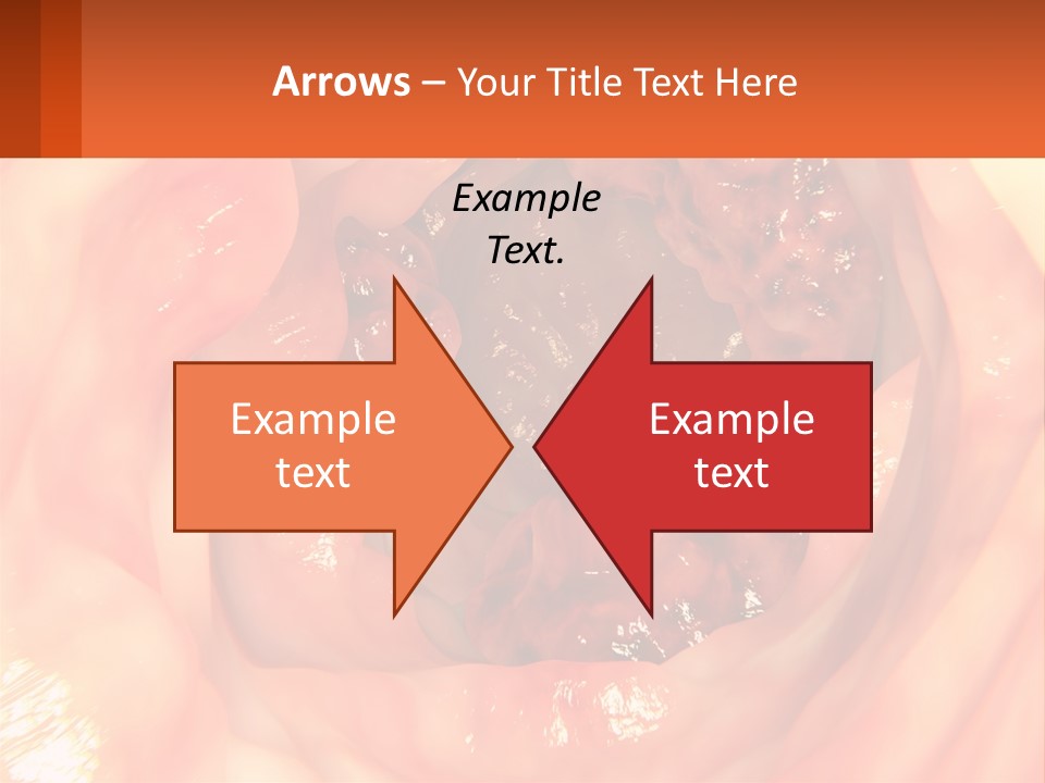 Ulcer PowerPoint Template