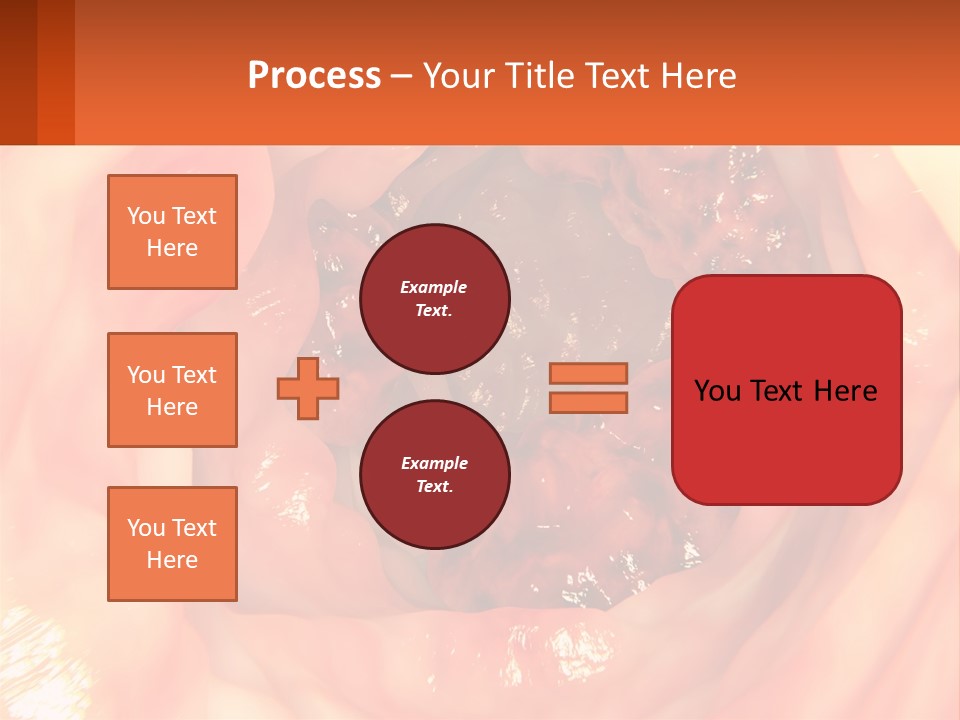 Ulcer PowerPoint Template