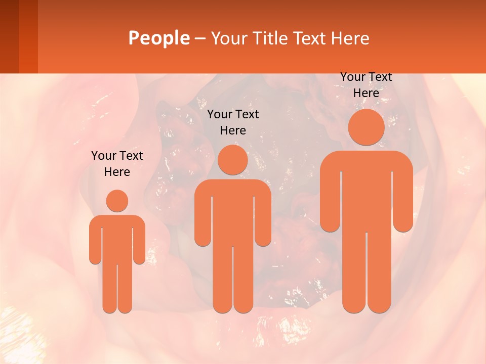 Ulcer PowerPoint Template