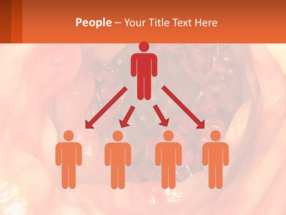 Ulcer PowerPoint Template