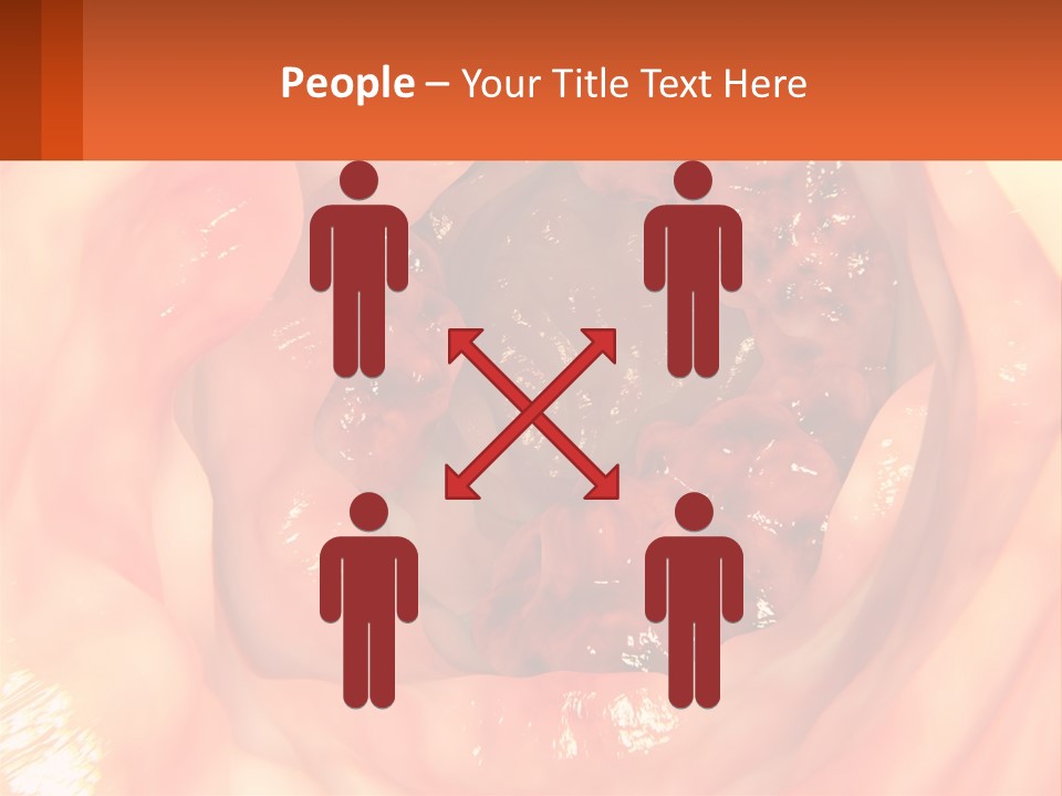 Ulcer PowerPoint Template