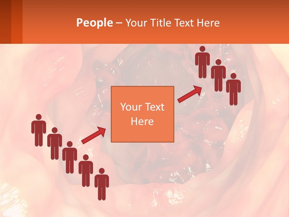 Ulcer PowerPoint Template