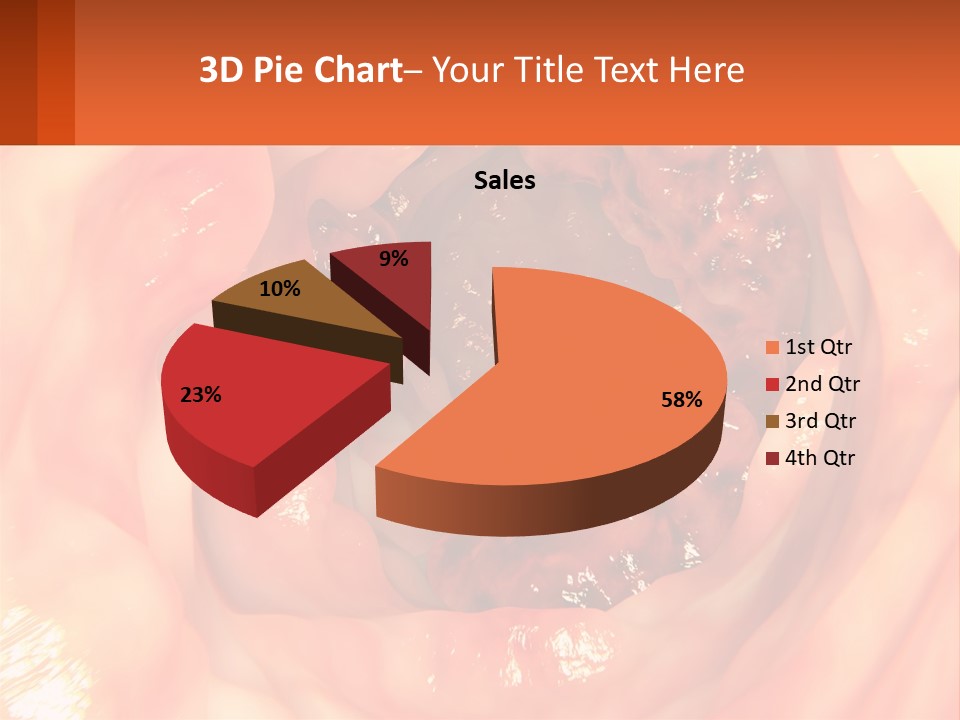 Ulcer PowerPoint Template