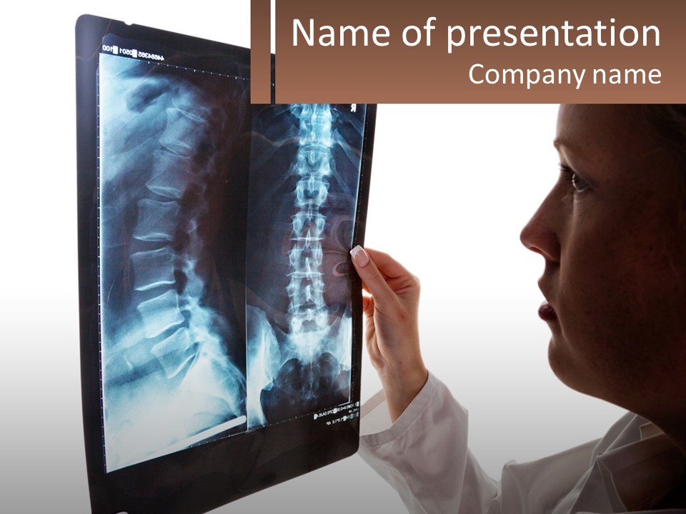 X-Ray Of The Spine PowerPoint Template
