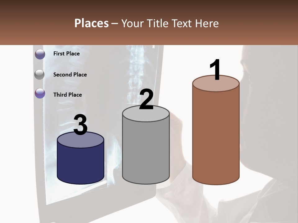 X-Ray Of The Spine PowerPoint Template