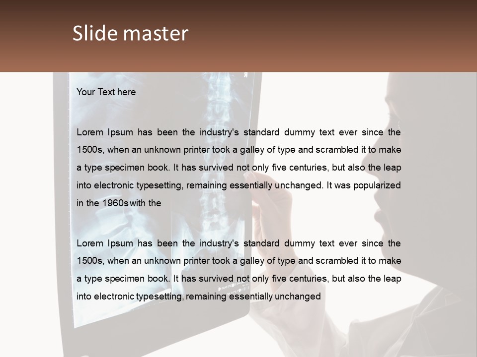 X-Ray Of The Spine PowerPoint Template