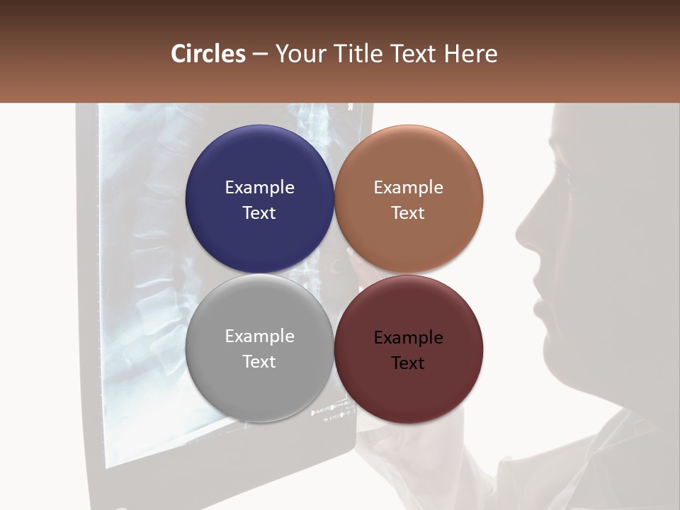 X-Ray Of The Spine PowerPoint Template