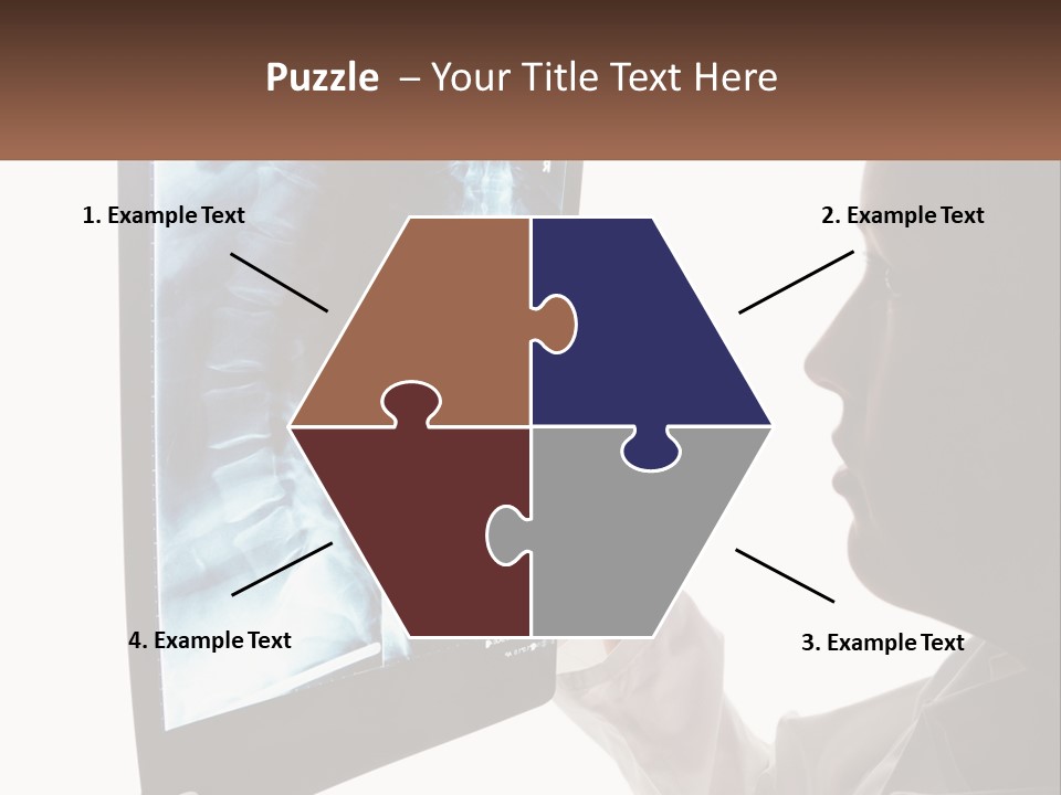 X-Ray Of The Spine PowerPoint Template