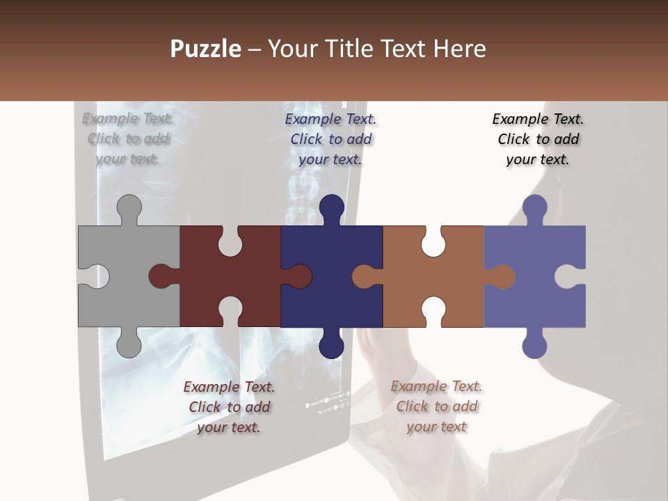 X-Ray Of The Spine PowerPoint Template