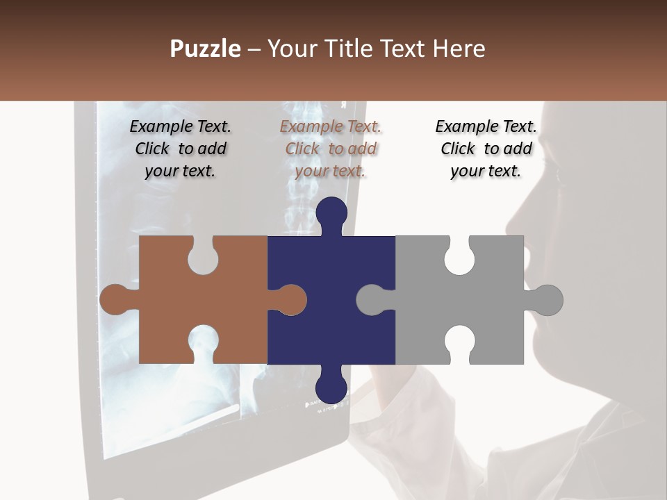 X-Ray Of The Spine PowerPoint Template