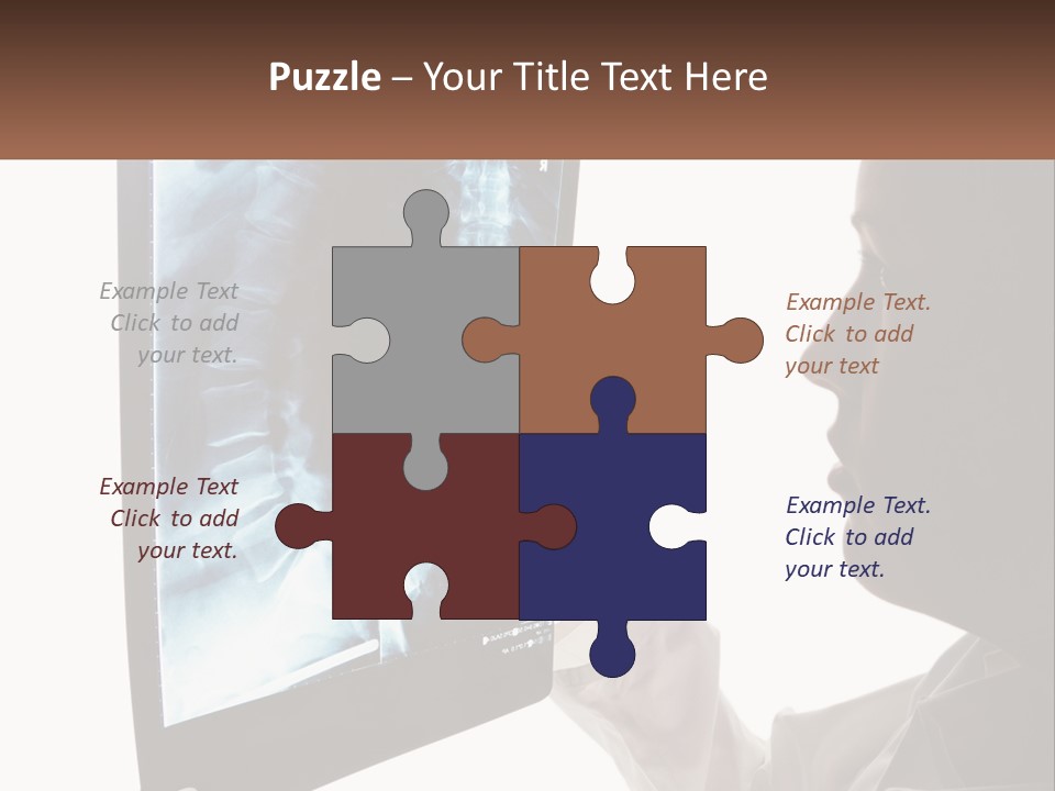 X-Ray Of The Spine PowerPoint Template