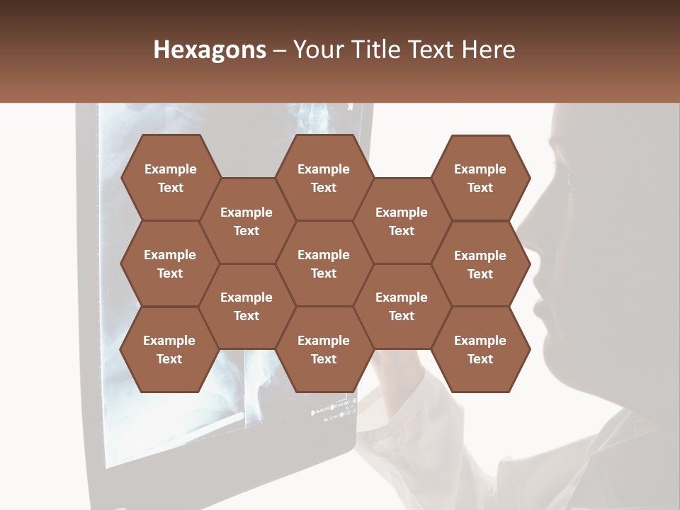 X-Ray Of The Spine PowerPoint Template