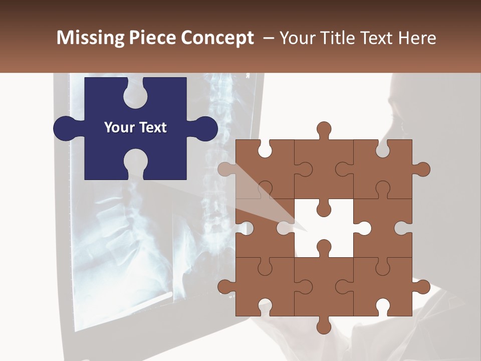 X-Ray Of The Spine PowerPoint Template