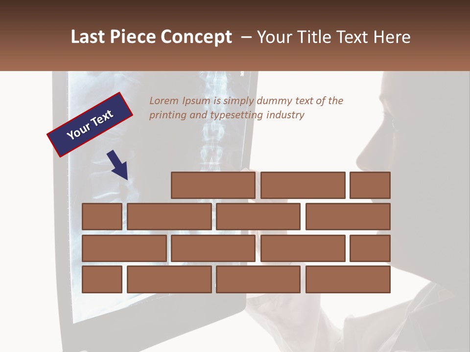 X-Ray Of The Spine PowerPoint Template