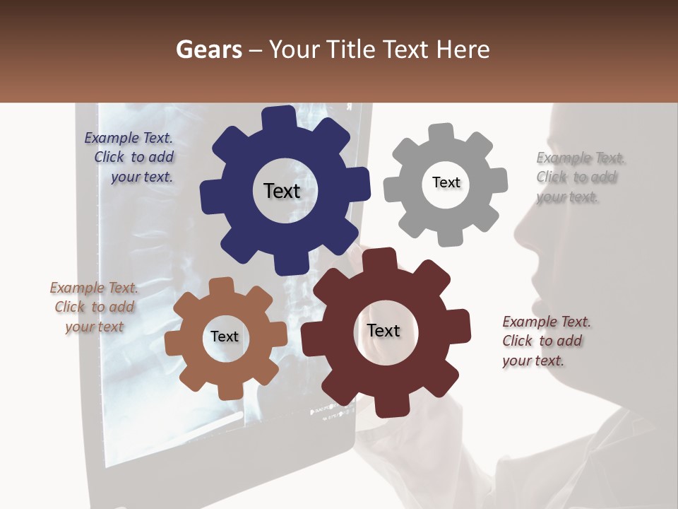 X-Ray Of The Spine PowerPoint Template