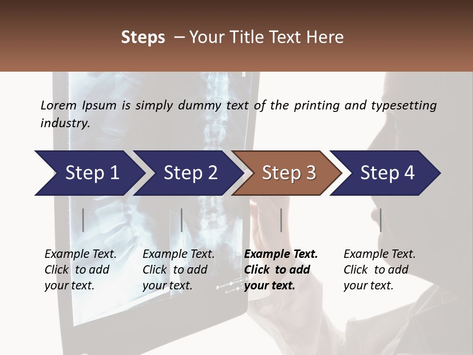 X-Ray Of The Spine PowerPoint Template